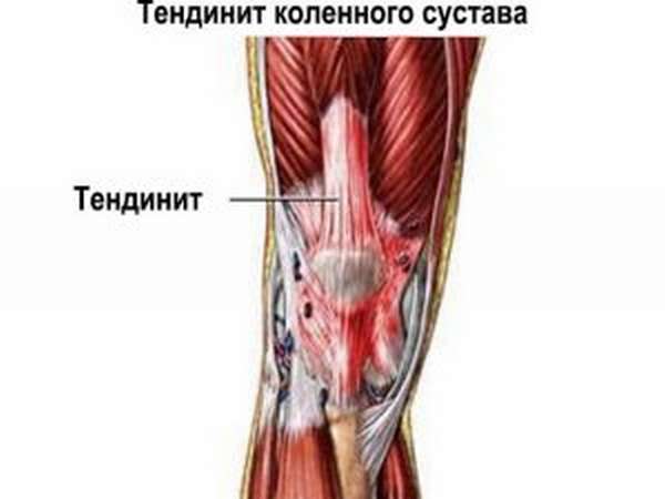 Заболевания коленного сустава